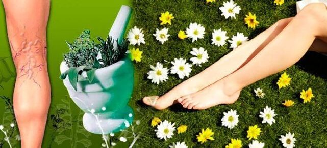 Folk remedies for treating varicose veins in the legs, contributing to rapid healing