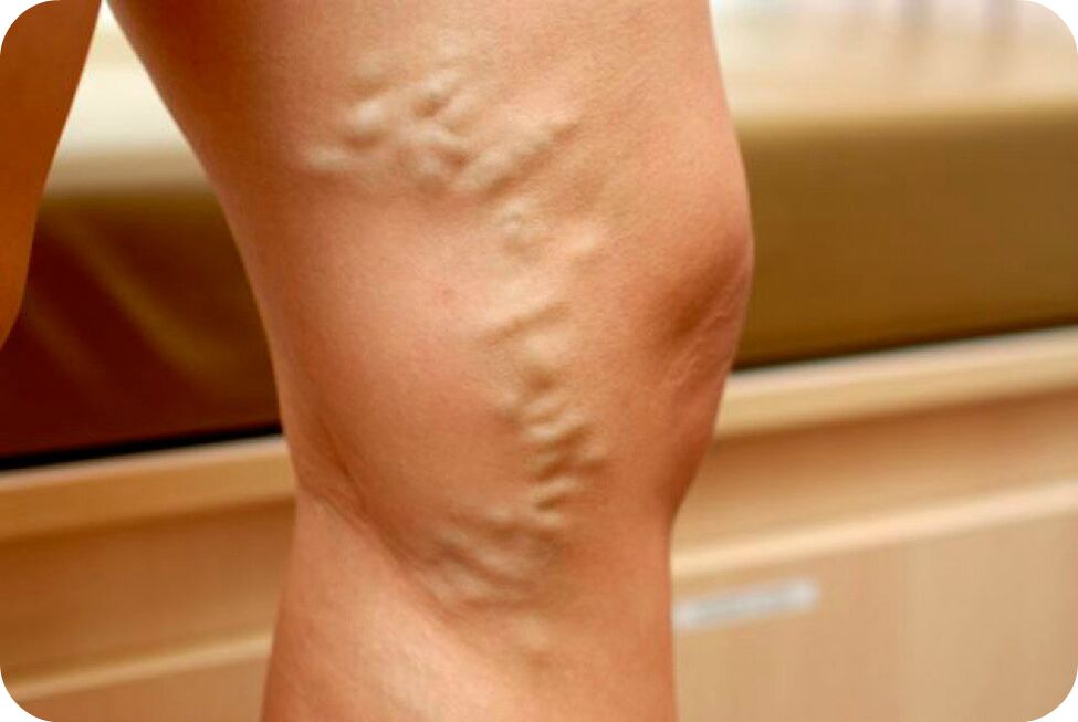 The veins
