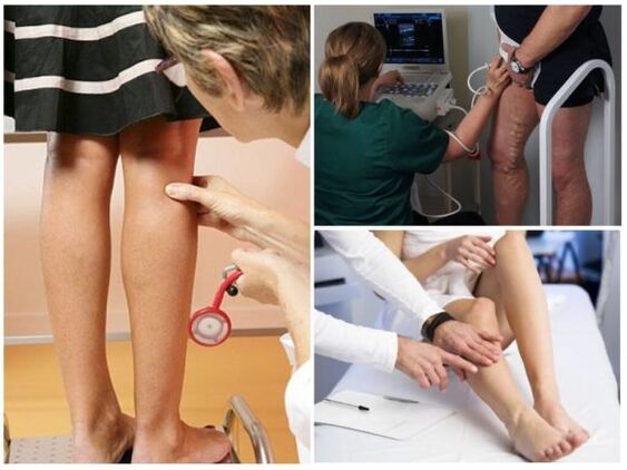 To diagnose varicoosa